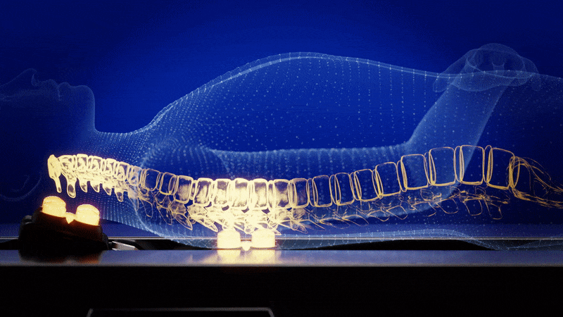 Intensive upper body care